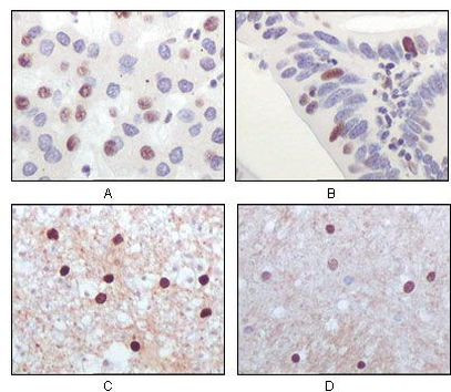 TIP60 Antibody in Immunohistochemistry (Paraffin) (IHC (P))