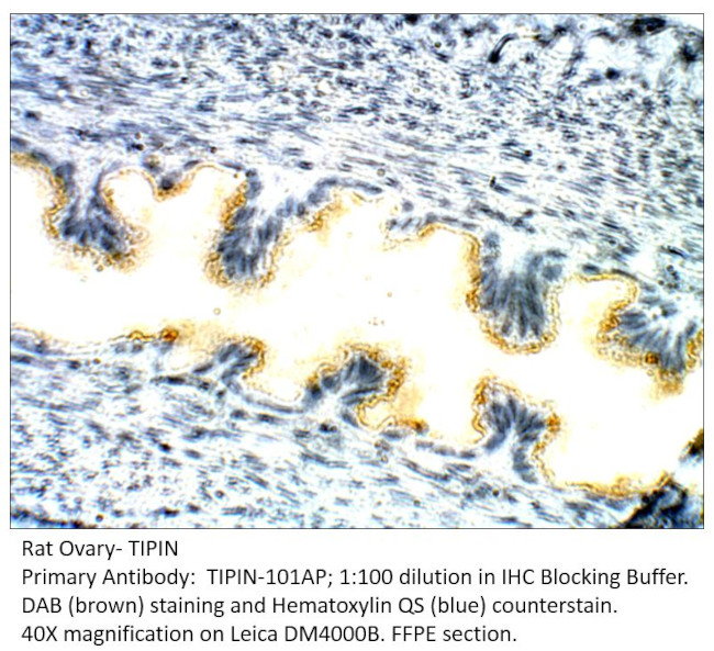 TIPIN Antibody in Immunohistochemistry (IHC)