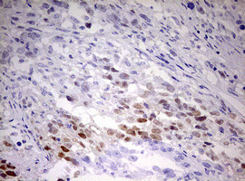 TIPIN Antibody in Immunohistochemistry (Paraffin) (IHC (P))