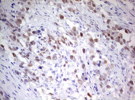 TIPIN Antibody in Immunohistochemistry (Paraffin) (IHC (P))