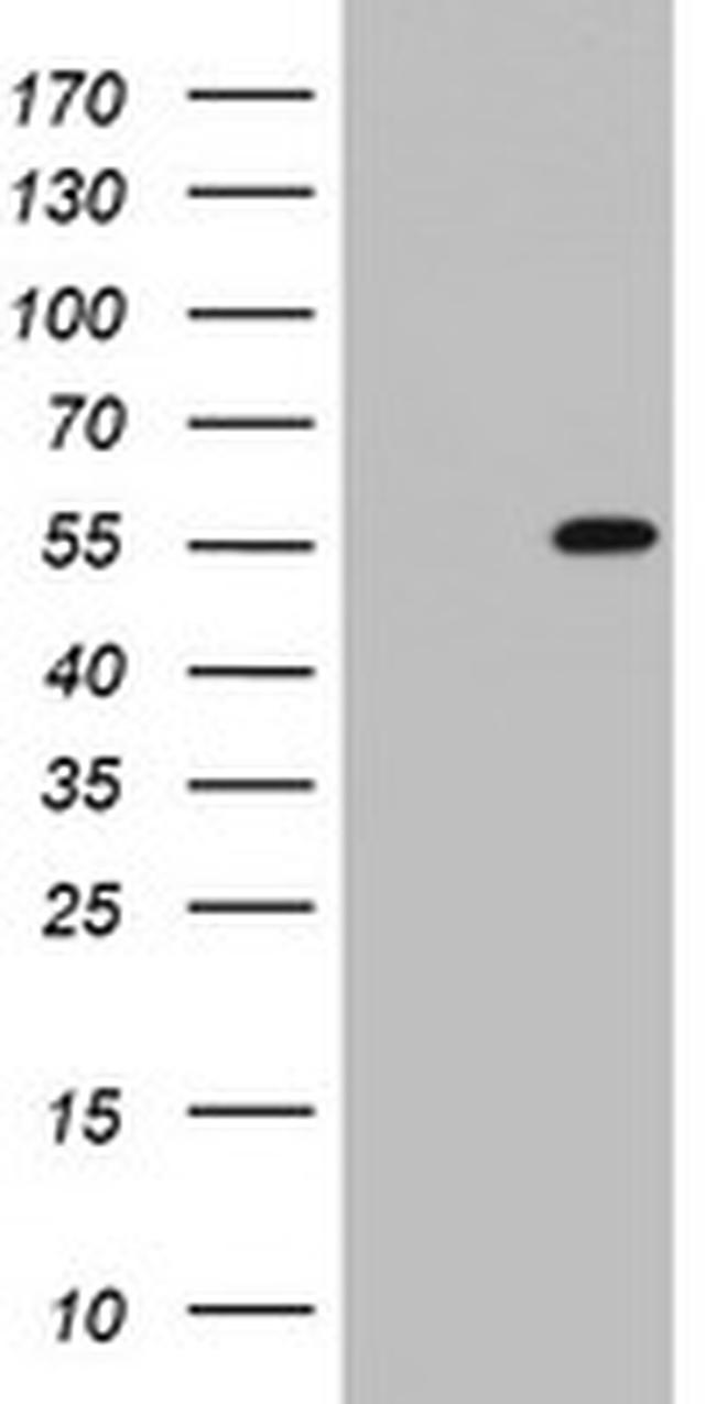 TIPIN Antibody in Western Blot (WB)