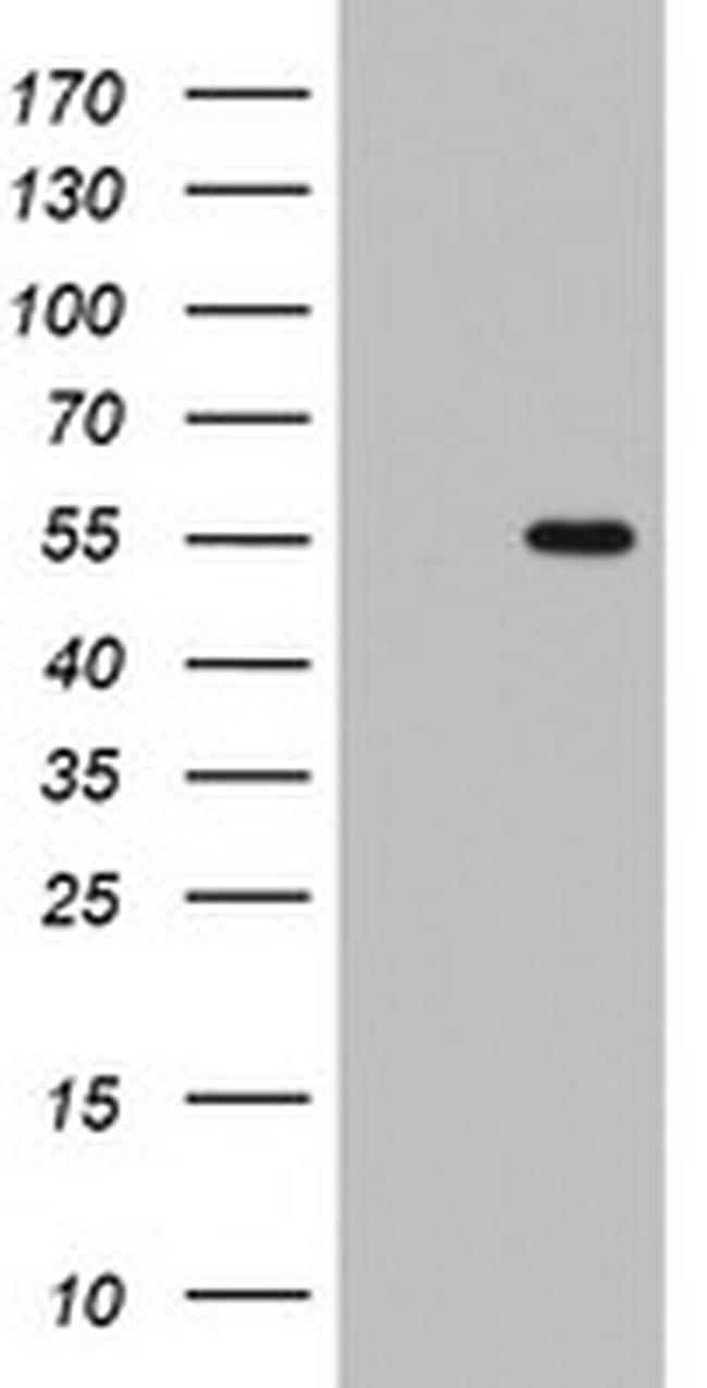 TIPIN Antibody in Western Blot (WB)