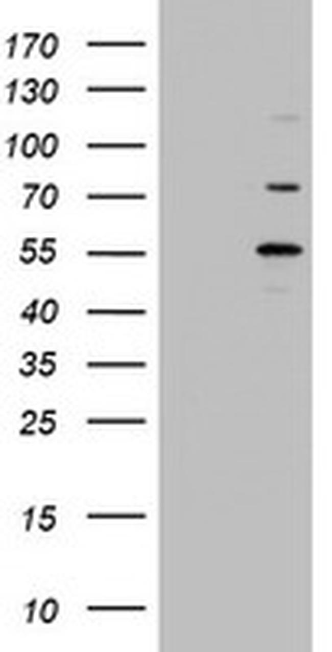 TIPIN Antibody in Western Blot (WB)