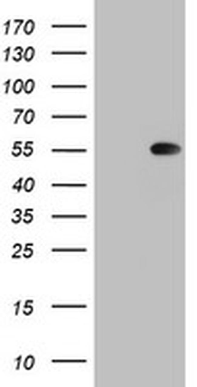 TIPIN Antibody in Western Blot (WB)