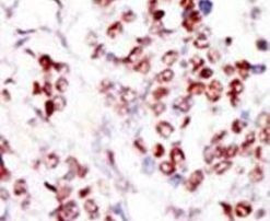 TLK1 Antibody in Immunohistochemistry (IHC)