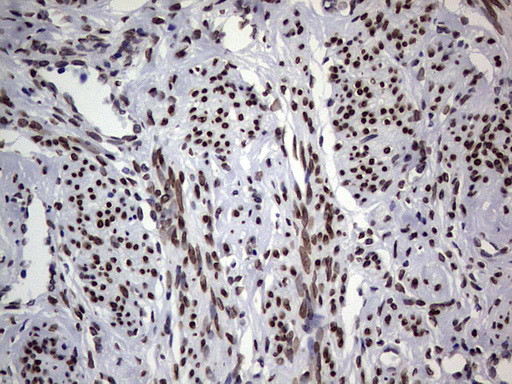 TLK2 Antibody in Immunohistochemistry (Paraffin) (IHC (P))