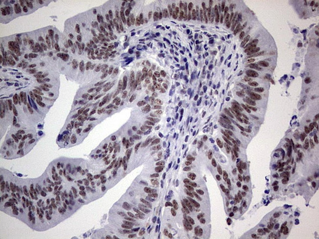 TLK2 Antibody in Immunohistochemistry (Paraffin) (IHC (P))