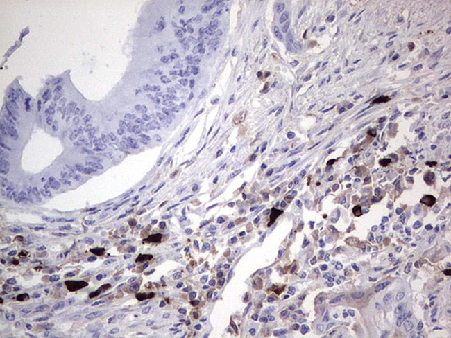 TLK2 Antibody in Immunohistochemistry (Paraffin) (IHC (P))