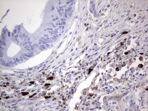 TLK2 Antibody in Immunohistochemistry (Paraffin) (IHC (P))
