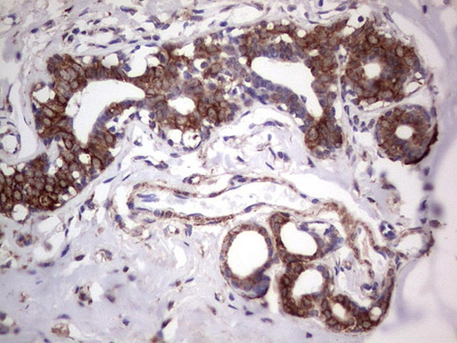 TLK2 Antibody in Immunohistochemistry (Paraffin) (IHC (P))