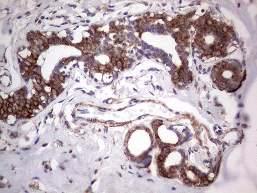 TLK2 Antibody in Immunohistochemistry (Paraffin) (IHC (P))