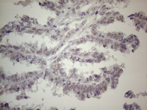 TLK2 Antibody in Immunohistochemistry (Paraffin) (IHC (P))
