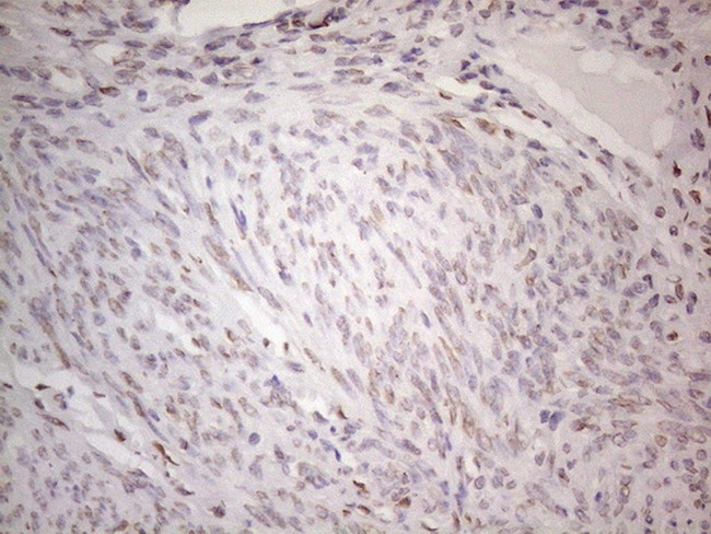 TLK2 Antibody in Immunohistochemistry (Paraffin) (IHC (P))