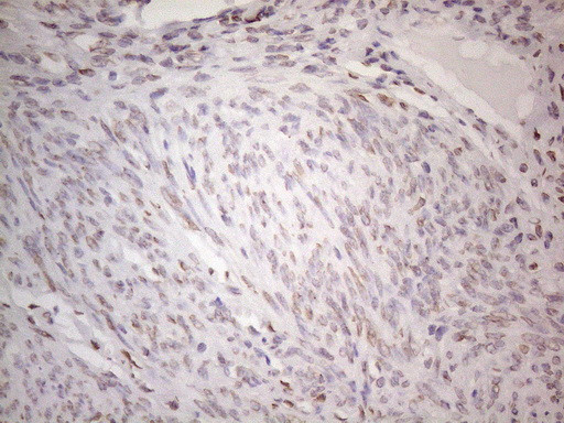 TLK2 Antibody in Immunohistochemistry (Paraffin) (IHC (P))