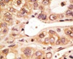 TLR5 Antibody in Immunohistochemistry (IHC)