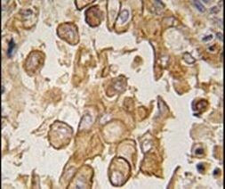 TLR6 Antibody in Immunohistochemistry (IHC)