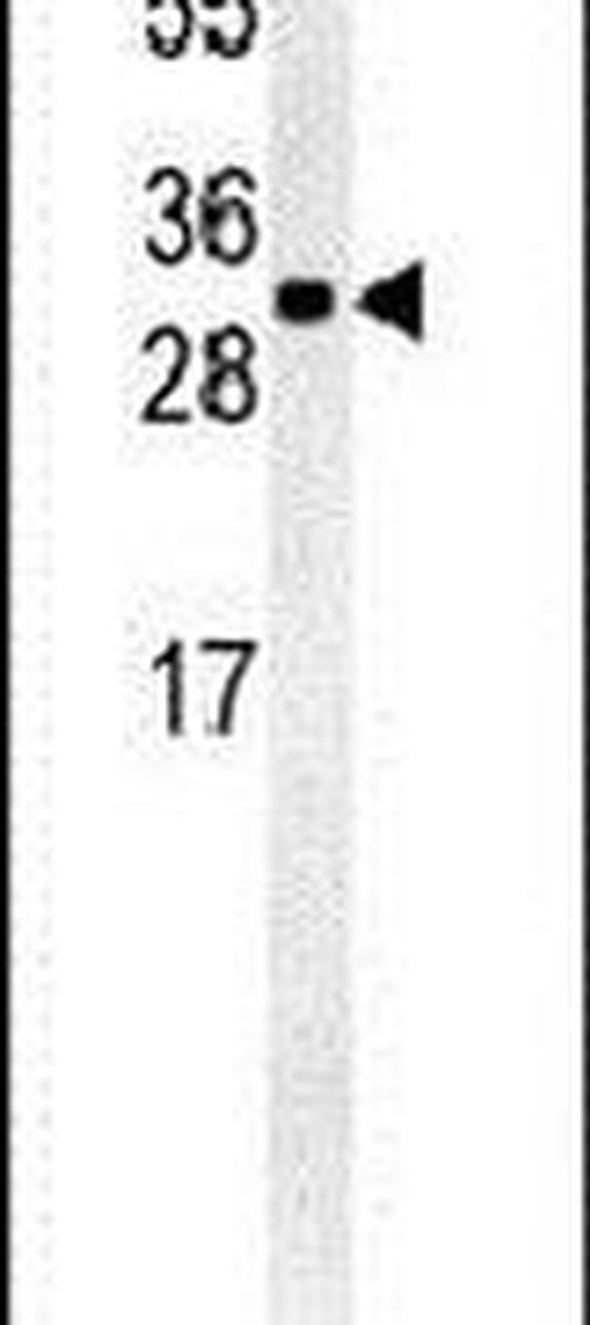 TM2D3 Antibody in Western Blot (WB)