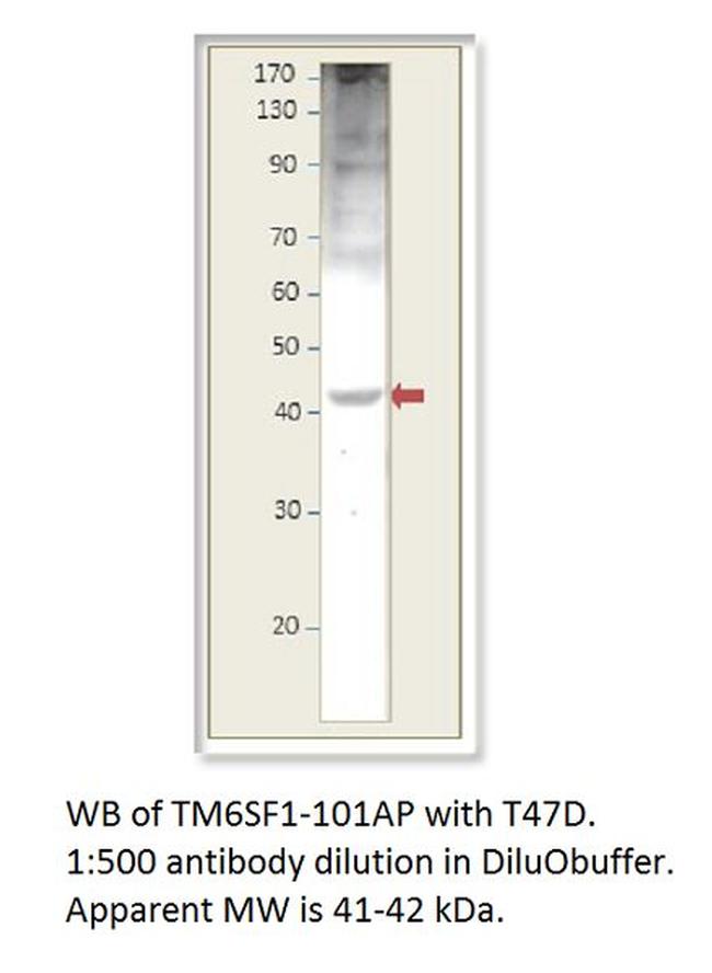 TM6SF1 Antibody in Western Blot (WB)