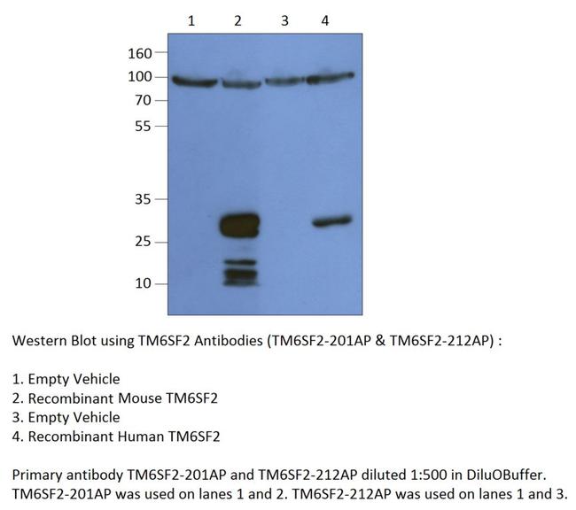 TM6SF2 Antibody in Western Blot (WB)