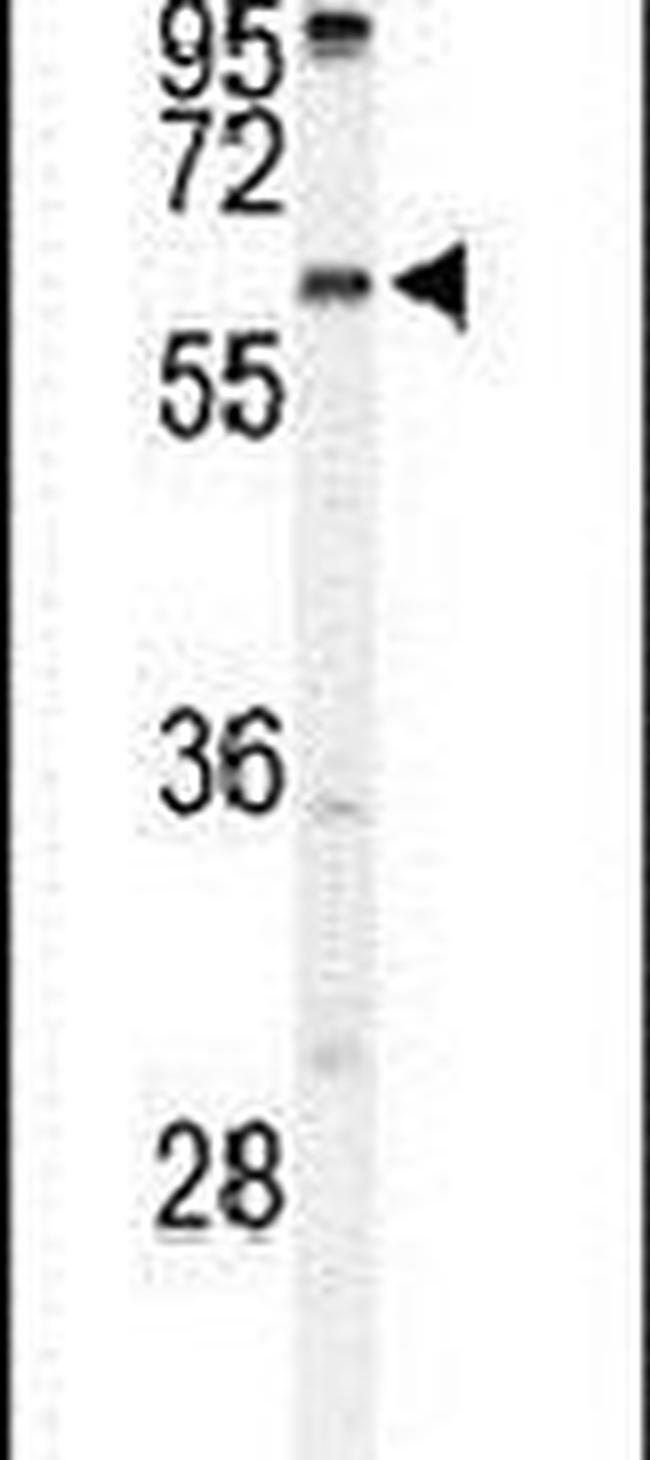 TMEM108 Antibody in Western Blot (WB)