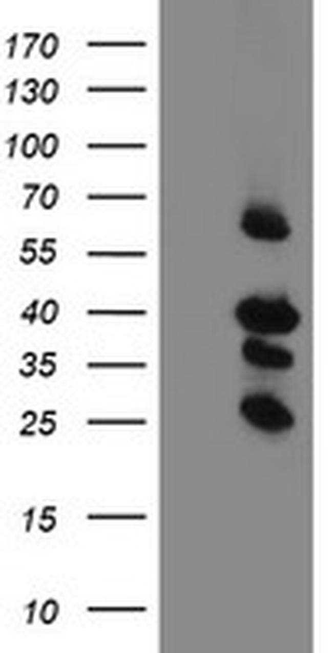 TMEM173 Antibody in Western Blot (WB)