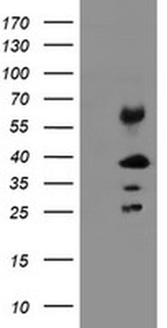 TMEM173 Antibody in Western Blot (WB)