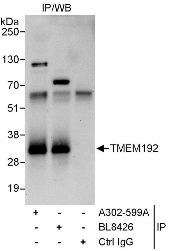 TMEM192 Antibody in Immunoprecipitation (IP)