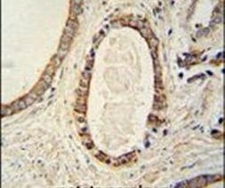 TMEM214 Antibody in Immunohistochemistry (IHC)