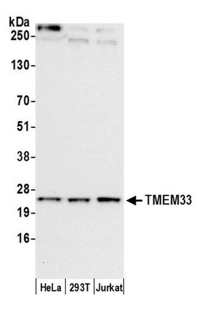 TMEM33 Antibody in Western Blot (WB)