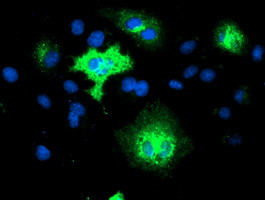 TMEM80 Antibody in Immunocytochemistry (ICC/IF)