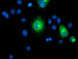 TMEM80 Antibody in Immunocytochemistry (ICC/IF)