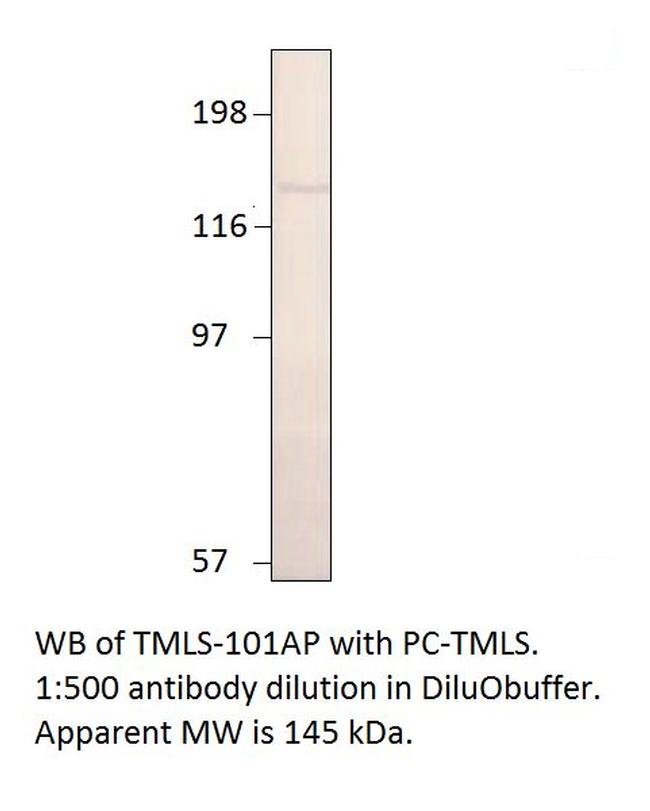 Timeless Antibody in Western Blot (WB)