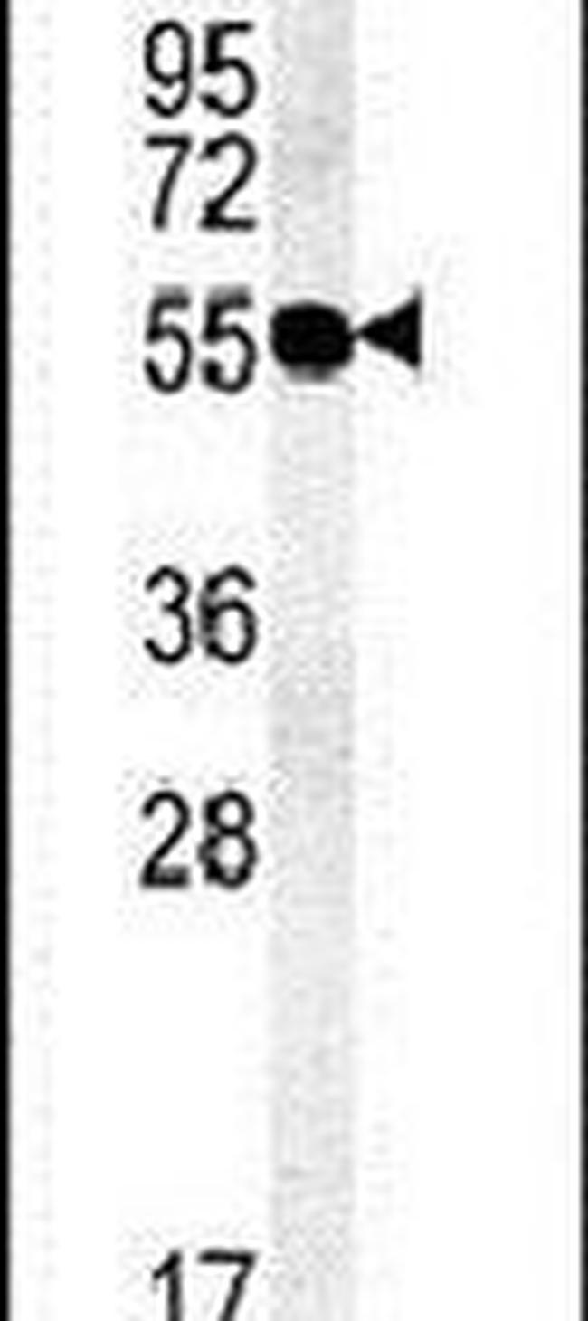 TMEM79 Antibody in Western Blot (WB)