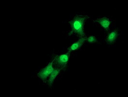 TMOD1 Antibody in Immunocytochemistry (ICC/IF)