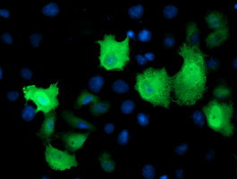 TMOD1 Antibody in Immunocytochemistry (ICC/IF)