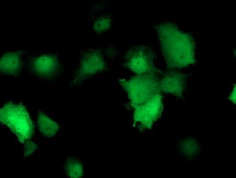 TMOD1 Antibody in Immunocytochemistry (ICC/IF)