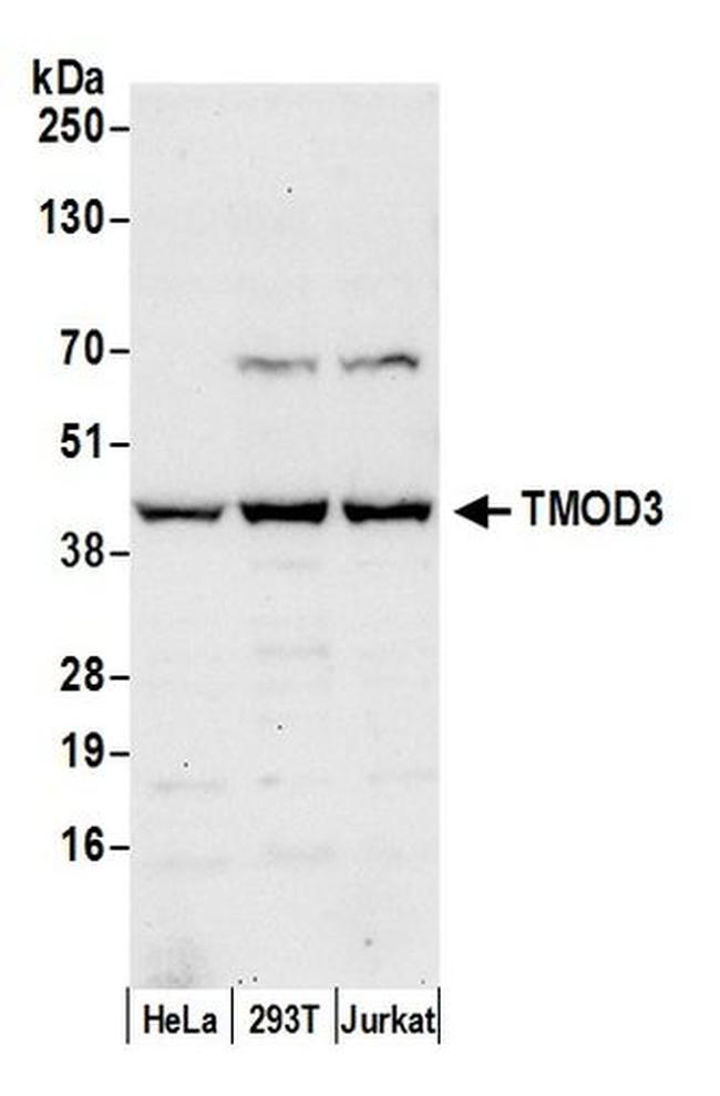 TMOD3 Antibody in Western Blot (WB)