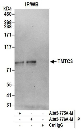 TMTC3 Antibody in Immunoprecipitation (IP)