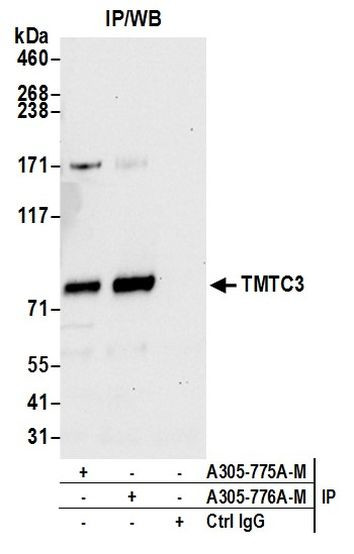 TMTC3 Antibody in Immunoprecipitation (IP)