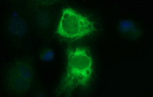 TMX1 Antibody in Immunocytochemistry (ICC/IF)