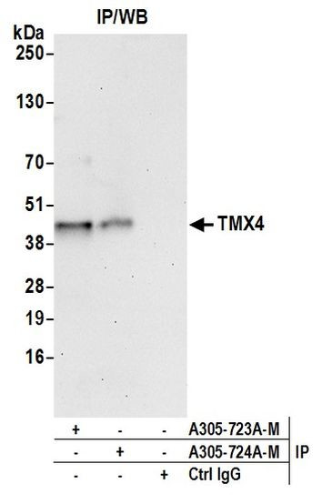 TMX4 Antibody in Immunoprecipitation (IP)