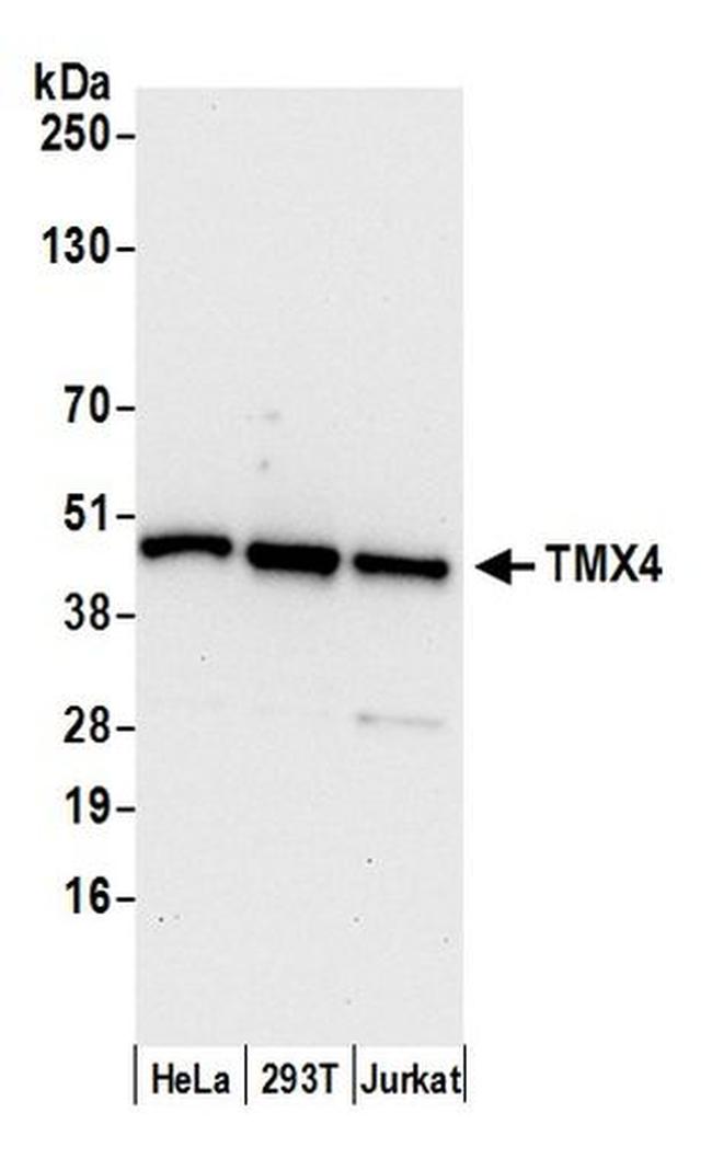 TMX4 Antibody in Western Blot (WB)