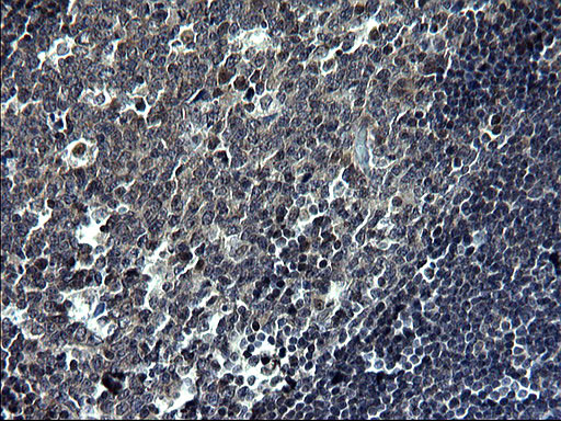 TNFA Antibody in Immunohistochemistry (Paraffin) (IHC (P))