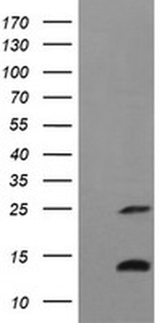 TNFA Antibody in Western Blot (WB)