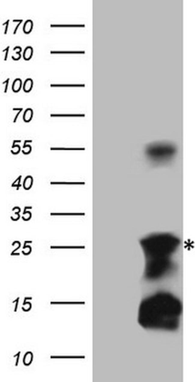 TNFA Antibody in Western Blot (WB)