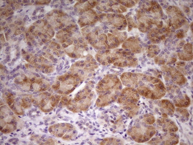 TNFRSF10B Antibody in Immunohistochemistry (Paraffin) (IHC (P))