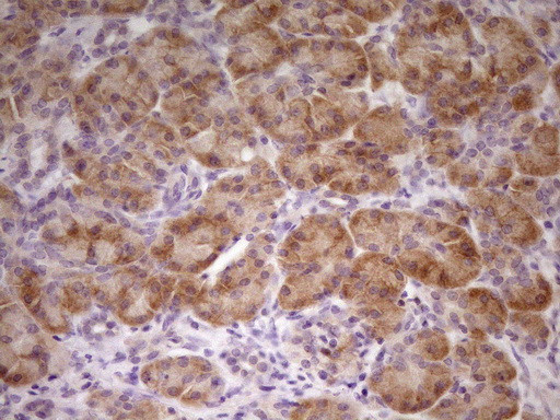 TNFRSF10B Antibody in Immunohistochemistry (Paraffin) (IHC (P))