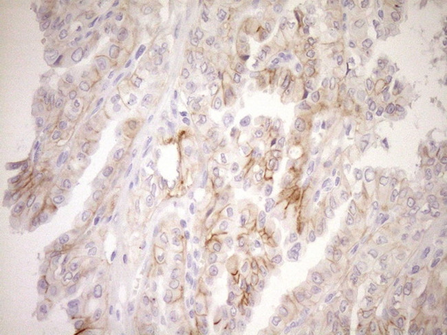 TNFRSF10B Antibody in Immunohistochemistry (Paraffin) (IHC (P))