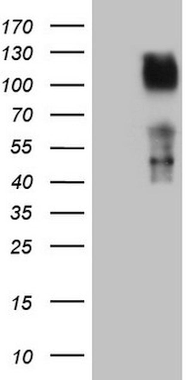 TNFRSF14 Antibody in Western Blot (WB)
