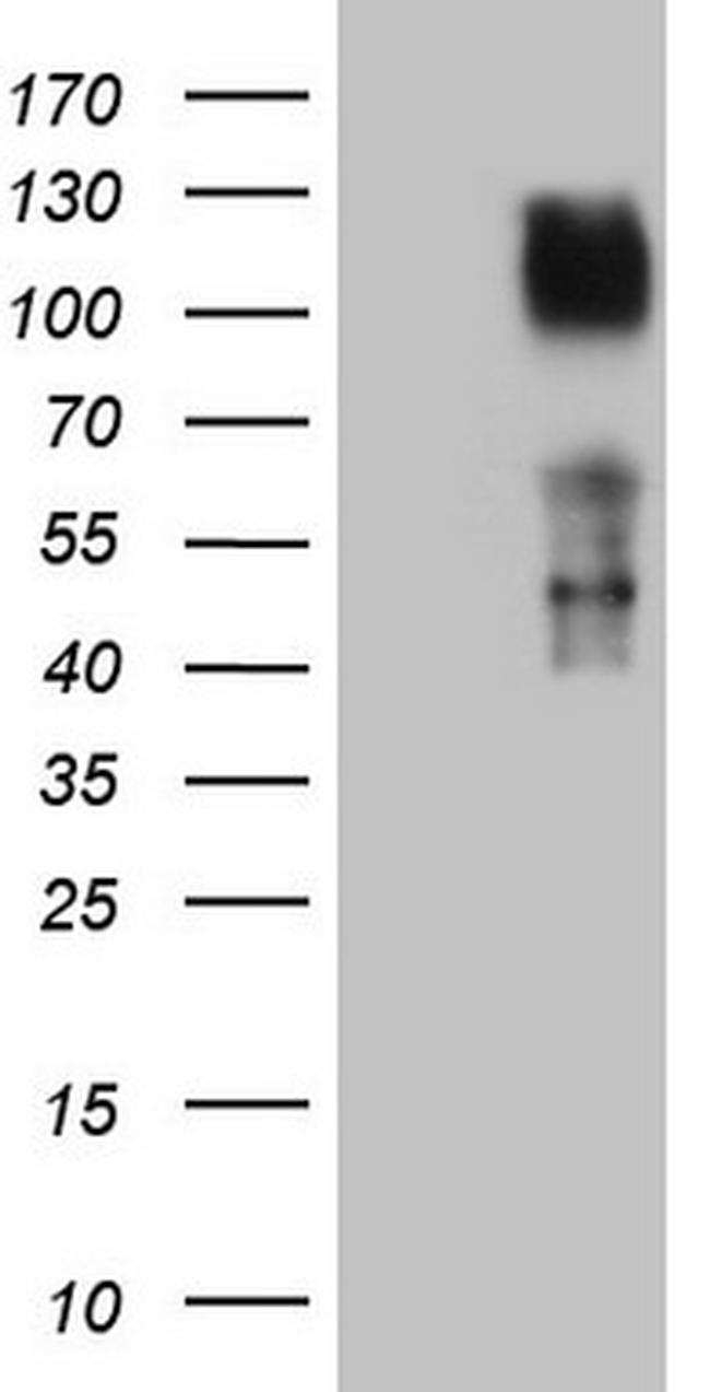TNFRSF14 Antibody in Western Blot (WB)